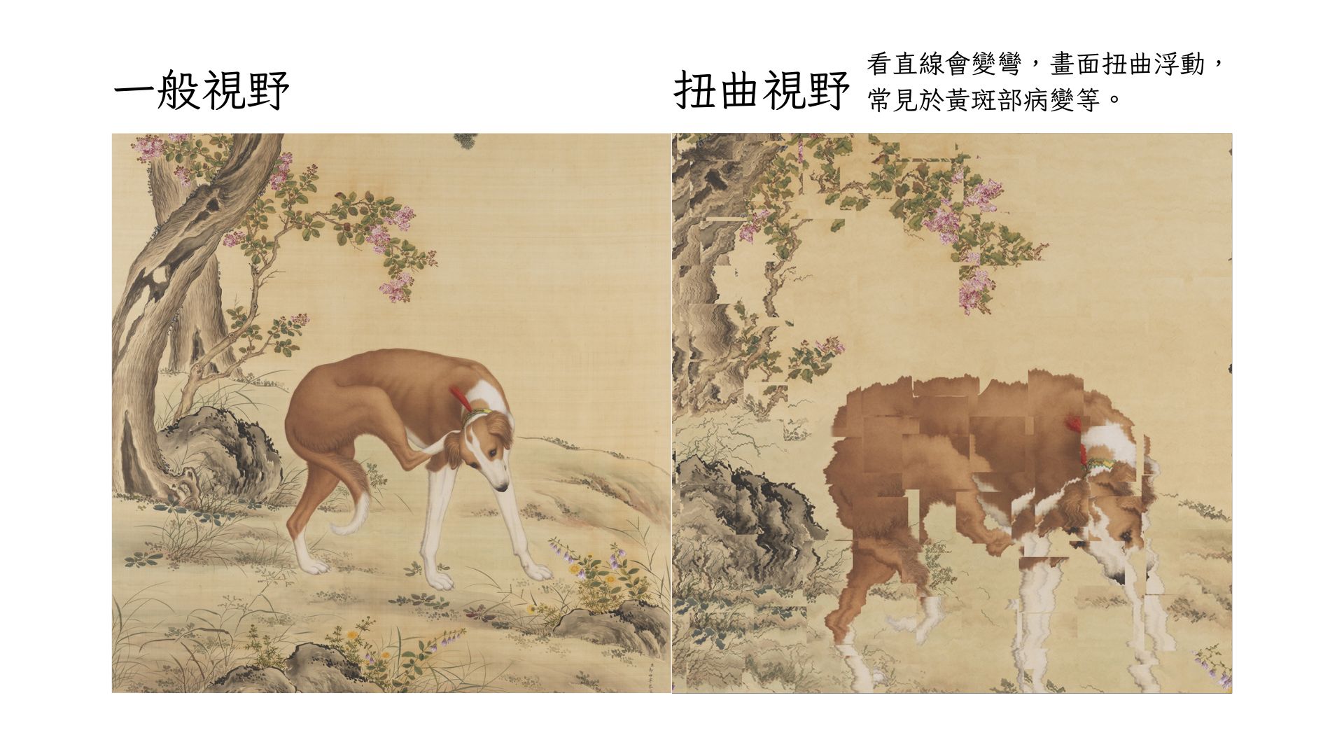 扭曲視野中央影像彎曲變形看直線會變彎畫面扭曲浮動常見於黃斑部病變