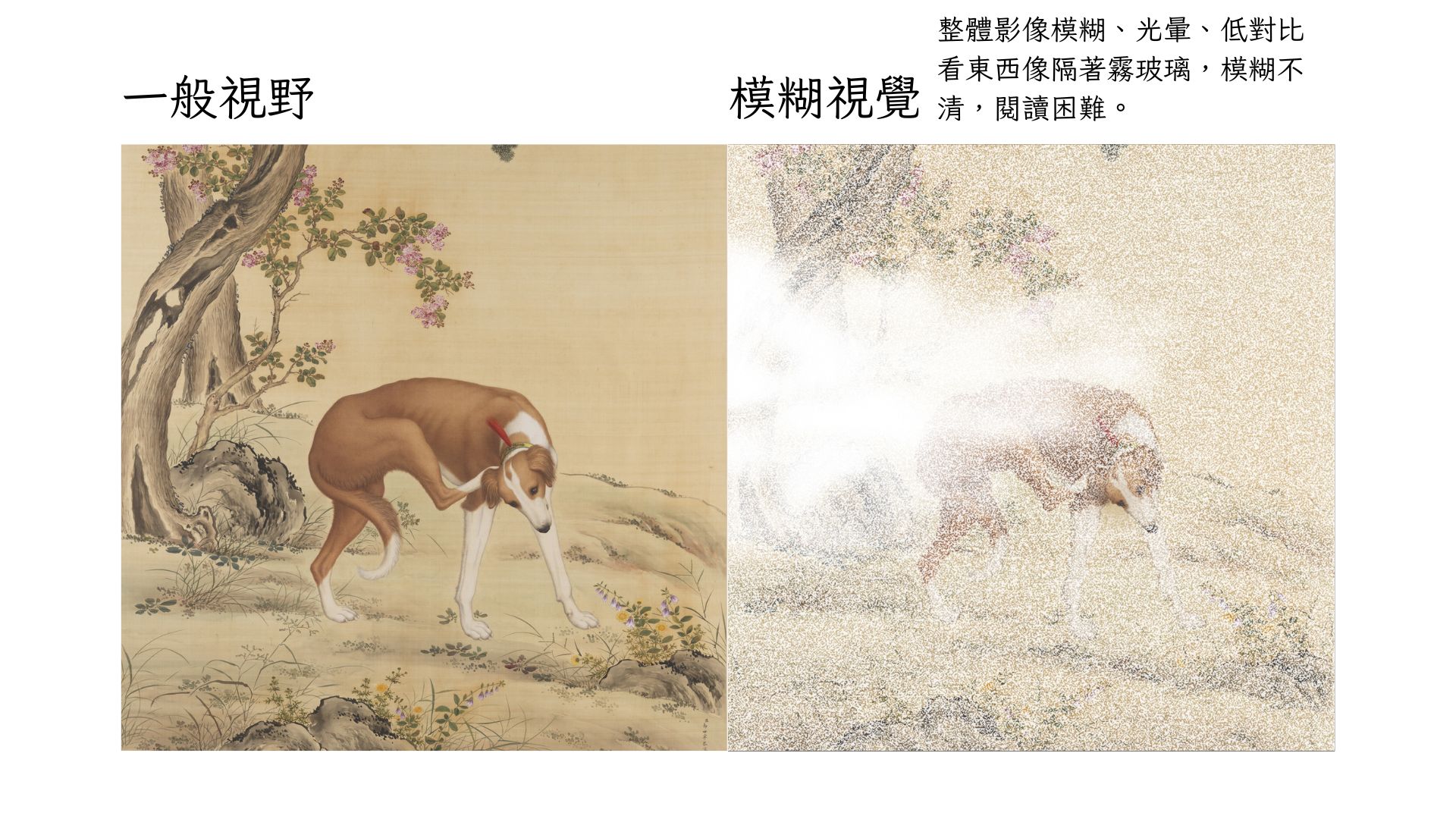 模糊視覺 整體影像模糊光暈低對比 看東西像隔著霧玻璃模糊不清閱讀困難